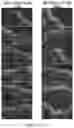 Fig. 05 - TOPICAL DELIVERY OF NUCLEIC ACID COMPOUNDS