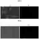 Fig. 04 - Pharmaceutical composition for oral administration comprising high concentration taxane