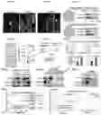 Fig. 02 - Methods for treating brain metastasis