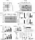 Fig. 04 - Methods for treating brain metastasis