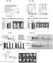 Fig. 16 - Methods for treating brain metastasis