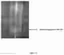 Fig. 03 - A MUCOADHESIVE OROMUCOSAL FORMULATION COMPRISING A NICOTINE COMPLEX