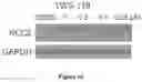 Fig. 11 - KCC2 expression enhancing compounds and uses thereof