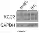 Fig. 13 - KCC2 expression enhancing compounds and uses thereof