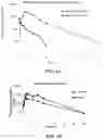 Fig. 04 - Methods for treating diseases associated with abnormal ACVR1 expression and ACVR1 inhibitors for use in the same