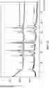 Fig. 16 - Methods for treating diseases associated with abnormal ACVR1 expression and ACVR1 inhibitors for use in the same