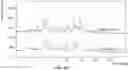 Fig. 27 - Methods for treating diseases associated with abnormal ACVR1 expression and ACVR1 inhibitors for use in the same