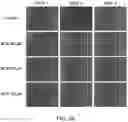 Fig. 03 - Methotrexate for proliferative vitreoretinopathy