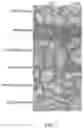 Fig. 03 - Sterol composition in pumpkin seed oil and application thereof, and drug for treating benign prostatic hyperplasia