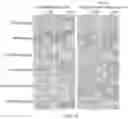 Fig. 04 - Sterol composition in pumpkin seed oil and application thereof, and drug for treating benign prostatic hyperplasia