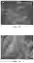 Fig. 11 - Dental and medical compositions having a multiple source of metallic ions