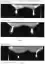 Fig. 02 - Intramammary Veterinary Composition
