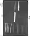 Fig. 15 - Immune cells expressing engineered antigen receptors