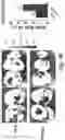 Fig. 14 - PLATELET VESICLE-ENGINEERED CELLS FOR TARGETED TISSUE REPAIR