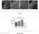 Fig. 13 - Methods and compositions for enhancing cardiomyocyte maturation and engraftment
