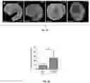 Fig. 14 - Methods and compositions for enhancing cardiomyocyte maturation and engraftment