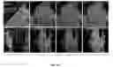 Fig. 15 - Methods and compositions for enhancing cardiomyocyte maturation and engraftment