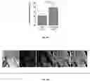 Fig. 17 - Methods and compositions for enhancing cardiomyocyte maturation and engraftment