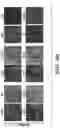 Fig. 25 - Methods and compositions for enhancing cardiomyocyte maturation and engraftment