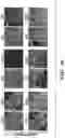 Fig. 26 - Methods and compositions for enhancing cardiomyocyte maturation and engraftment