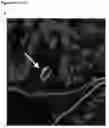 Fig. 22 - Compositions and methods for modulating growth of a genetically modified gut bacterial cell