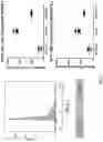 Fig. 10 - EXPRESSION OF PTEN-LONG WITH OCOLYTIC VIRUSES