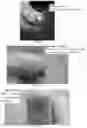 Fig. 06 - Tecoma plant based compositions for treating skin lesions