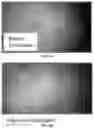 Fig. 10 - Tecoma plant based compositions for treating skin lesions