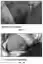 Fig. 11 - Tecoma plant based compositions for treating skin lesions