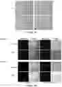 Fig. 04 - Method of treating a liver disease comprising administering ostreolysin orfunctionally related variant thereof