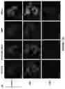 Fig. 19 - Method of treating a liver disease comprising administering ostreolysin orfunctionally related variant thereof