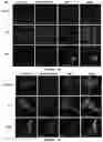 Fig. 20 - Method of treating a liver disease comprising administering ostreolysin orfunctionally related variant thereof