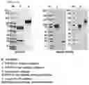 Fig. 06 - Protein complex by use of a specific site of an immunoglobulin fragment for linkage