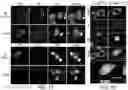 Fig. 02 - Mutant huntingtin-mediated protein dysfunction