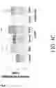 Fig. 10 - Compositions and methods for treatment of uremic cardiomyopathy