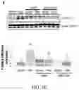 Fig. 15 - Compositions and methods for treatment of uremic cardiomyopathy