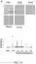 Fig. 22 - Compositions and methods for treatment of uremic cardiomyopathy