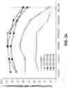Fig. 05 - METHODS FOR TREATMENT OF MASSETER MUSCLE HYPERTROPHY