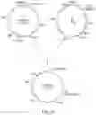 Fig. 16 - HUMAN APPLICATION OF ENGINEERED CHIMERIC ANTIGEN RECEPTOR (CAR) T-CELLS