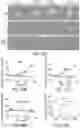 Fig. 27 - HUMAN APPLICATION OF ENGINEERED CHIMERIC ANTIGEN RECEPTOR (CAR) T-CELLS
