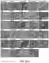 Fig. 29 - HUMAN APPLICATION OF ENGINEERED CHIMERIC ANTIGEN RECEPTOR (CAR) T-CELLS