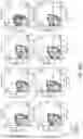 Fig. 47 - HUMAN APPLICATION OF ENGINEERED CHIMERIC ANTIGEN RECEPTOR (CAR) T-CELLS
