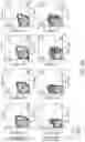 Fig. 48 - HUMAN APPLICATION OF ENGINEERED CHIMERIC ANTIGEN RECEPTOR (CAR) T-CELLS