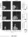 Fig. 60 - HUMAN APPLICATION OF ENGINEERED CHIMERIC ANTIGEN RECEPTOR (CAR) T-CELLS