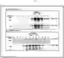 Fig. 04 - VLP-BASED MONOVALENT EBOLA VACCINES AND METHODS OF MAKING AND USING SAME
