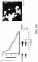 Fig. 05 - Treatment method utilizing chikungunya virus (CHIKV) virus-like particles (VLPS) comprising the C, E2 and E1 structural proteins