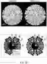 Fig. 06 - Treatment method utilizing chikungunya virus (CHIKV) virus-like particles (VLPS) comprising the C, E2 and E1 structural proteins