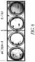Fig. 07 - Attenuated mutant dengue viruses comprising a mutation in the NS5 non-structural protein