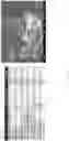 Fig. 17 - Noncrushable pill formulations