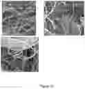 Fig. 15 - Nanoreservoir coated medical devices, biomaterials, and bioprosthetics